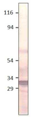 Western Blot: Aquaporin-11 Antibody [NBP3-12234]