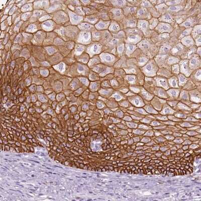 Immunohistochemistry-Paraffin: Aquaporin-3 Antibody [NBP2-33872]