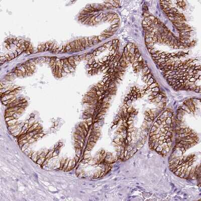 Immunohistochemistry-Paraffin: Aquaporin-3 Antibody [NBP2-33872]