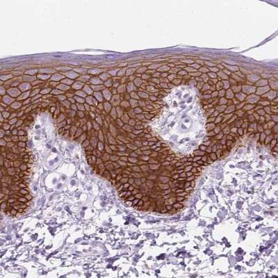 Immunohistochemistry-Paraffin: Aquaporin-3 Antibody [NBP2-33872]