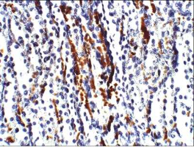 Immunohistochemistry-Paraffin: Aquaporin-3 Antibody [NBP3-12259]