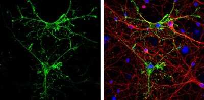 Immunocytochemistry/ Immunofluorescence: Aquaporin-4 Antibody [NBP3-12902]