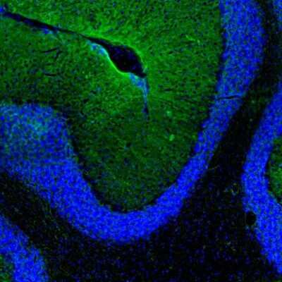 Immunohistochemistry: Aquaporin-4 Antibody [NBP1-87679]