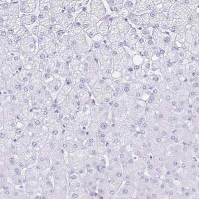 Immunohistochemistry-Paraffin: Aquaporin-4 Antibody [NBP1-87679]