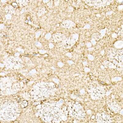 Immunohistochemistry-Paraffin: Aquaporin-4 Antibody - Azide and BSA Free [NBP2-92886]