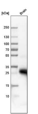 Western Blot: Aquaporin-4 Antibody [NBP1-87679]