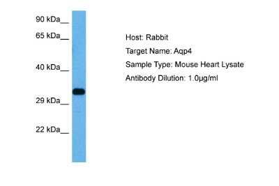 Western Blot: Aquaporin-4 Antibody [NBP2-87018]