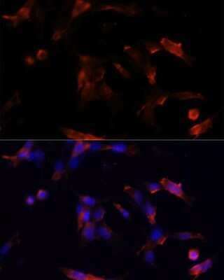 Immunocytochemistry/ Immunofluorescence: Aquaporin-5 Antibody - Azide and BSA Free [NBP2-92926]