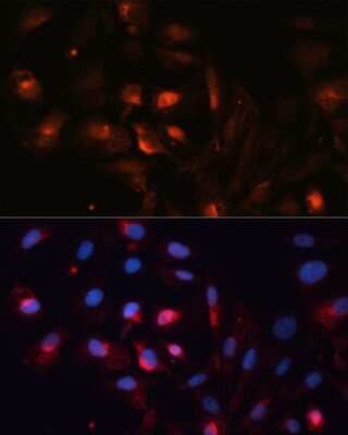 Immunocytochemistry/ Immunofluorescence: Aquaporin-5 Antibody - Azide and BSA Free [NBP2-92926]