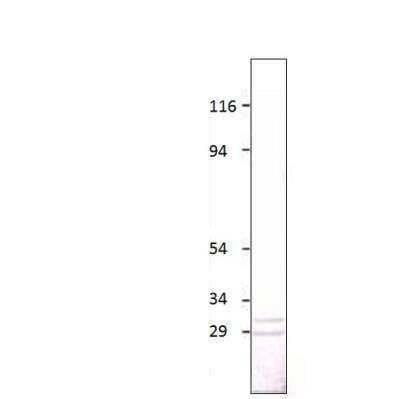 Western Blot: Aquaporin-5 Antibody [NBP3-12286]