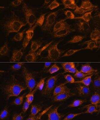 Immunocytochemistry/ Immunofluorescence: Aquaporin-8 Antibody - BSA Free [NBP2-92557]