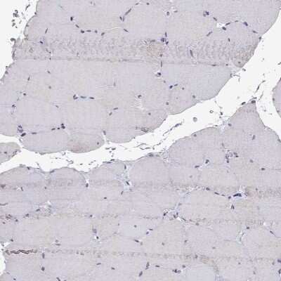 Immunohistochemistry-Paraffin: Aquaporin-9 Antibody [NBP2-62691]
