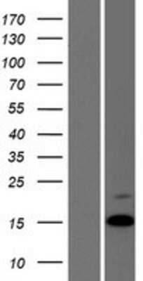 Western Blot: Antidiuretic Hormone Overexpression Lysate [NBP2-10674]