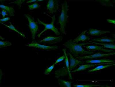 Immunocytochemistry/ Immunofluorescence: ArgRS Antibody [H00057038-B01P]