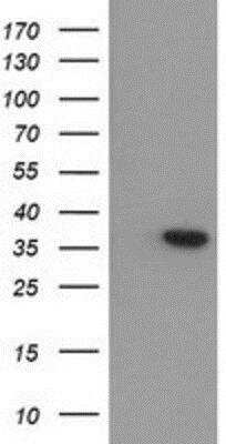 Western Blot: Arginase 1/ARG1/liver Arginase Antibody (OTI4E6) [NBP2-03618]