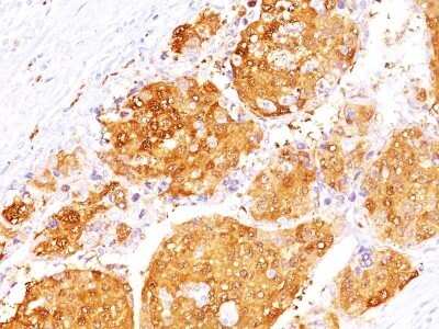 Immunohistochemistry-Paraffin: Arginase 1/ARG1/liver Arginase Antibody (ARG1/1125 + ARG1/1126) - Azide and BSA Free [NBP2-48000]