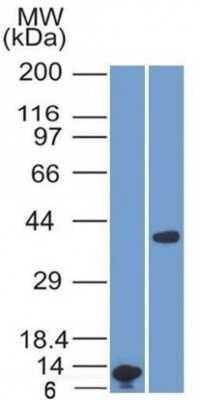 Western Blot: Arginase 1/ARG1/liver Arginase Antibody (ARG1/1125)Azide and BSA Free [NBP2-47998]