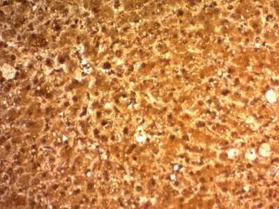 Immunohistochemistry-Paraffin: Arginase 1/ARG1/liver Arginase Antibody (ARG1/1126) - Azide and BSA Free [NBP2-47999]