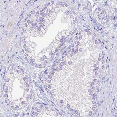Immunohistochemistry-Paraffin: Arginase 1/ARG1/liver Arginase Antibody (CL0186) [NBP2-14787]