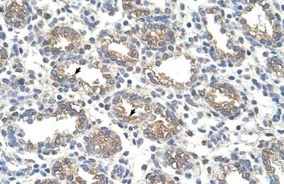 Immunohistochemistry-Paraffin: Arginase 1/ARG1/liver Arginase Antibody [NBP1-54621]