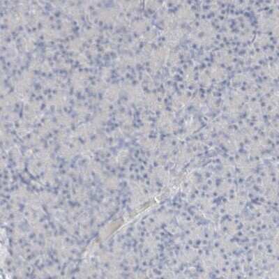 Immunohistochemistry-Paraffin: Arginase 1/ARG1/liver Arginase Antibody [NBP1-87455]