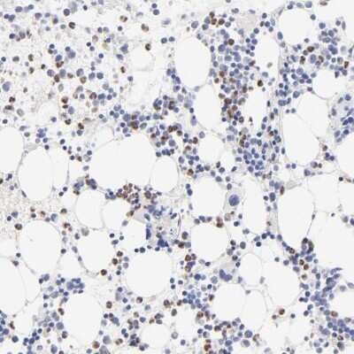 Immunohistochemistry-Paraffin: Arginase 1/ARG1/liver Arginase Antibody [NBP1-87490]