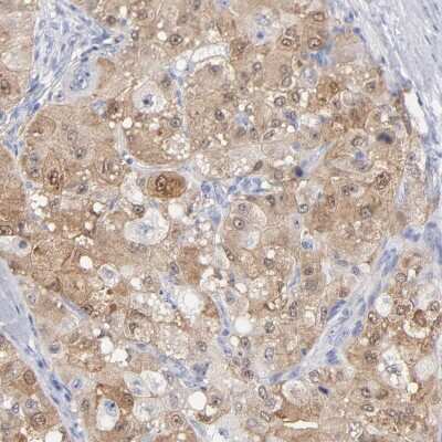 Immunohistochemistry-Paraffin: Arginase 1/ARG1/liver Arginase Antibody [NBP1-87490]