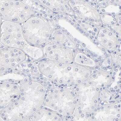 Immunohistochemistry-Paraffin: Arginase 1/ARG1/liver Arginase Antibody [NBP1-87490]