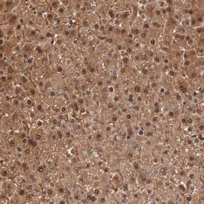 Immunohistochemistry-Paraffin: Arginase 1/ARG1/liver Arginase Antibody [NBP1-87490]