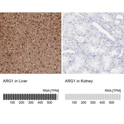 Immunohistochemistry-Paraffin: Arginase 1/ARG1/liver Arginase Antibody [NBP1-87490]