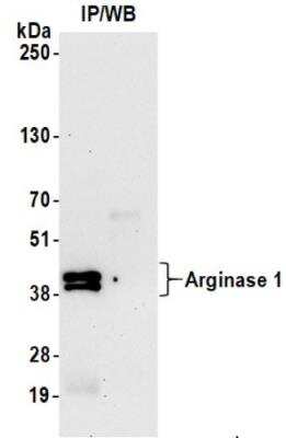 Immunoprecipitation: Arginase 1/ARG1/liver Arginase Antibody (BLR161J) [NBP3-14735]