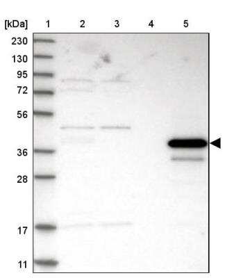 Western Blot: Arginase 1/ARG1/liver Arginase Antibody [NBP1-87455]