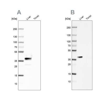 Western Blot: Arginase 1/ARG1/liver Arginase Antibody [NBP1-87490]