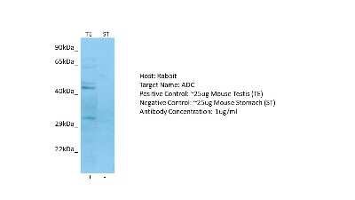 Western Blot: Arginine decarboxylase Antibody [NBP2-86579]
