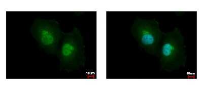 Immunocytochemistry/ Immunofluorescence: Argininosuccinate Lyase Antibody [NBP1-32752]