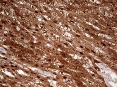 Immunohistochemistry: Argininosuccinate Lyase Antibody (OTI3D4) - Azide and BSA Free [NBP2-70213]
