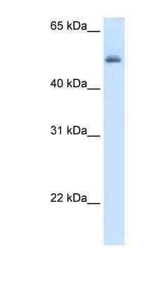 Western Blot: Argininosuccinate Lyase Antibody [NBP1-55125]