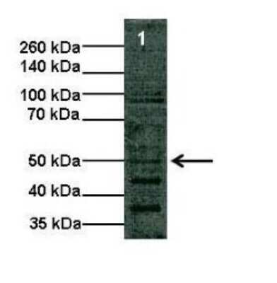 Western Blot: Argininosuccinate Lyase Antibody [NBP1-55125]