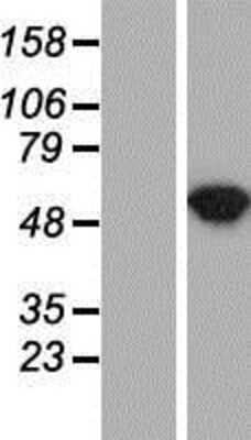 Western Blot: Argininosuccinate Lyase Overexpression Lysate [NBP2-11036]