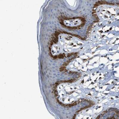 Immunohistochemistry-Paraffin: Argininosuccinate Synthase Antibody [NBP1-88867]
