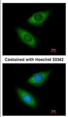 Immunocytochemistry/ Immunofluorescence: Arginyl tRNA synthetase Antibody [NBP2-15448]