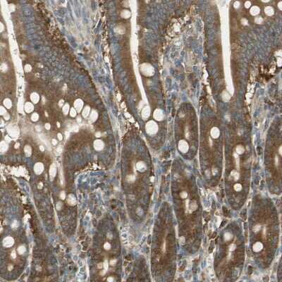 Immunohistochemistry-Paraffin: Arginyl tRNA synthetase Antibody [NBP1-88032]