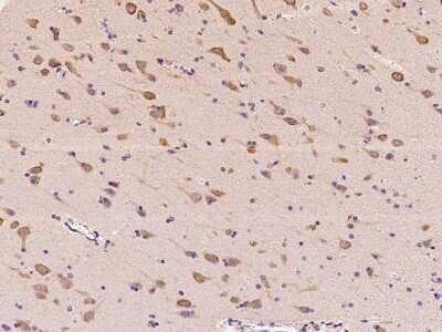 Immunohistochemistry-Paraffin: Arginyl tRNA synthetase Antibody [NBP2-97635]