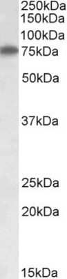 Western Blot: Arginyl tRNA synthetase Antibody [NBP1-46148]