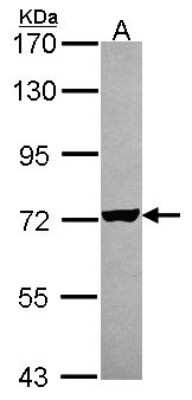 Western Blot: Arginyl tRNA synthetase Antibody [NBP2-15448]