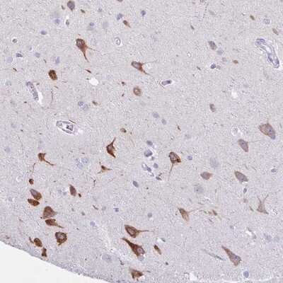 Immunohistochemistry-Paraffin: Argonaute 3 Antibody [NBP2-13951]
