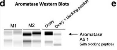 Simple Western: Aromatase Antibody [NB100-1596]