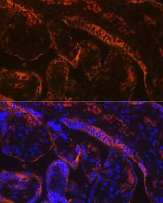 Immunohistochemistry: Aromatase Antibody (5C5N7) [NBP3-15438]