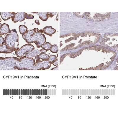 Immunohistochemistry-Paraffin: Aromatase Antibody [NBP2-48998]