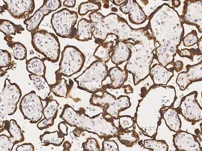 Immunohistochemistry-Paraffin: Aromatase Antibody [NBP2-99064]